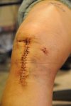 knee.jpg