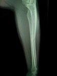 IMG_20131202_094632_540.jpg