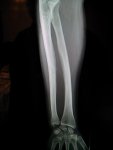 IMG_20131202_094621_465.jpg